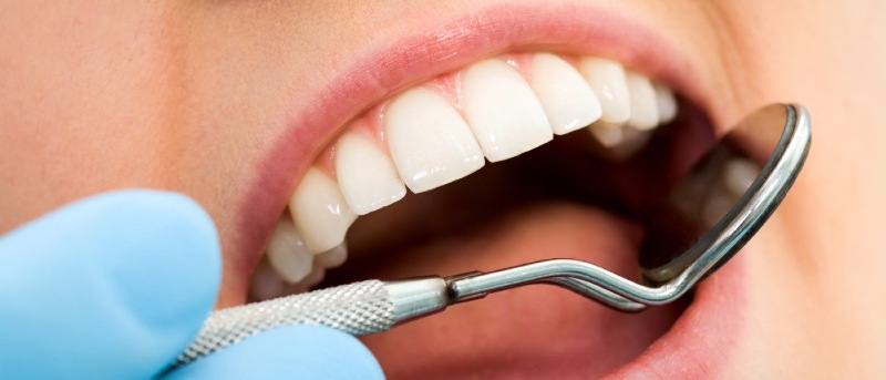Comment éliminer la plaque dentaire ?